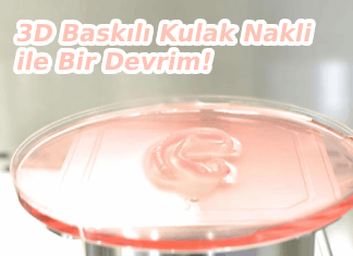 3D Baskılı Kulak Nakli ile Bir Devrim!