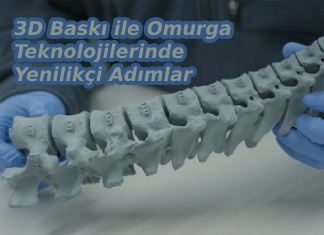 3D Baskı ile Omurga Teknolojilerinde Yenilikçi Adımlar